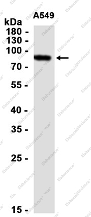 Recombinant DGKA Monoclonal Antibody - 2