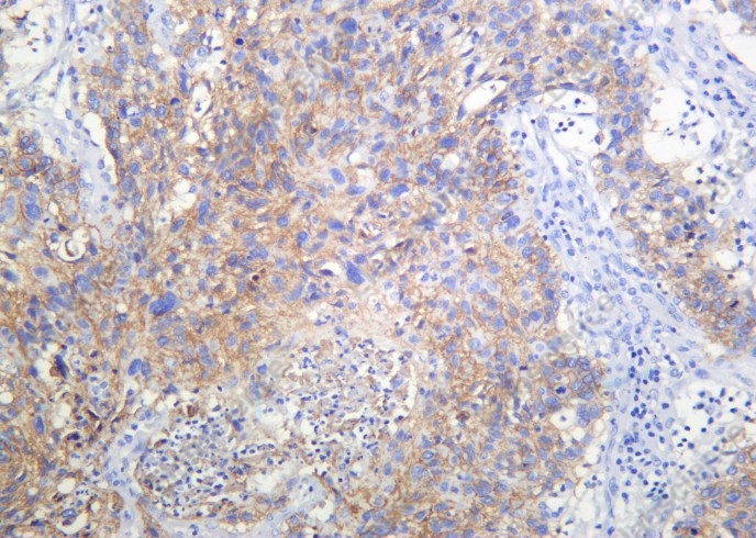 Recombinant RSK3 Monoclonal Antibody - 1