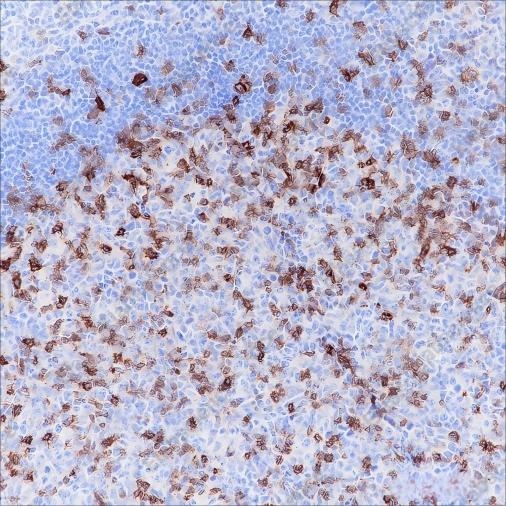 Recombinant CD278/ICOS Monoclonal Antibody - 2