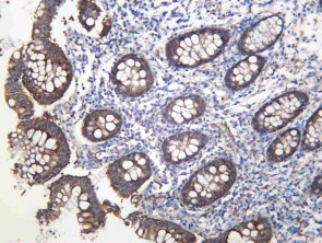Recombinant Synaptotagmin 1 Monoclonal Antibody - 1