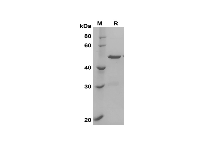 Recombinant Human FGF2 Protein(GST Tag)-1
