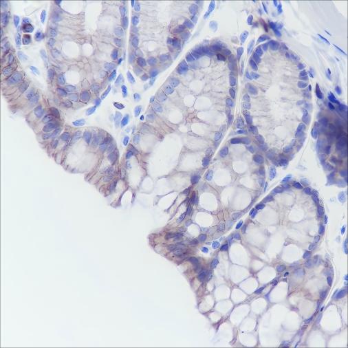 Recombinant Cadherin-17 Monoclonal Antibody - 2
