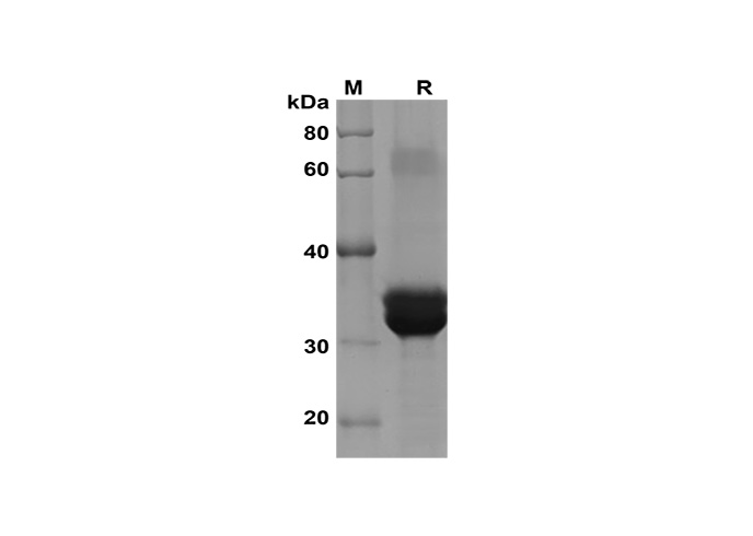 Recombinant Human IL-11 protein(Trx Tag)-产品推荐-1