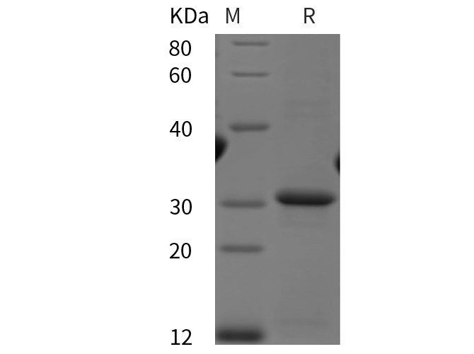 Recombinant Human 2B4/CD244 Protein(His Tag)-产品推荐-1