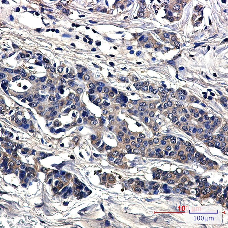 Recombinant SOD1/Superoxide Dismutase Monoclonal Antibody - 2