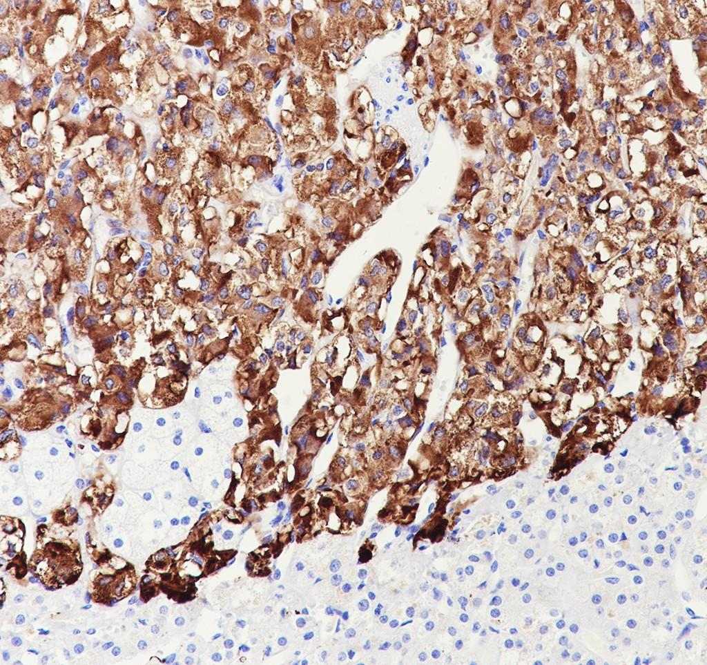 Recombinant Dopamine beta Hydroxylase Monoclonal Antibody-searchlist-1