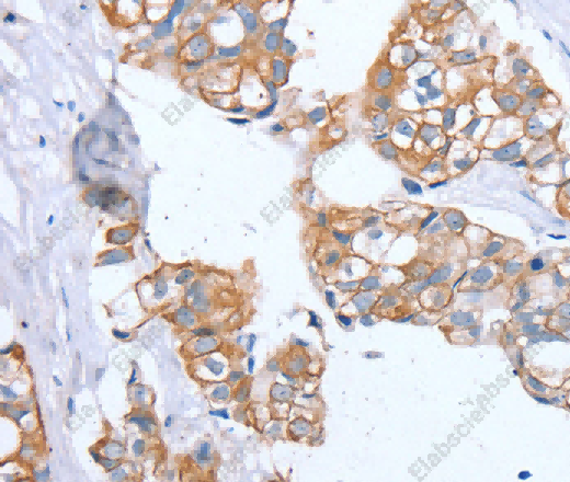 PTP4A2 Polyclonal Antibody - 2
