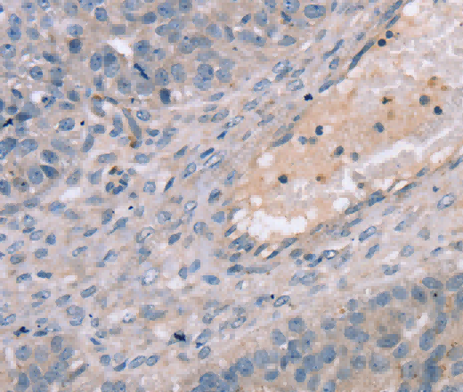 TERT Polyclonal Antibody - 2