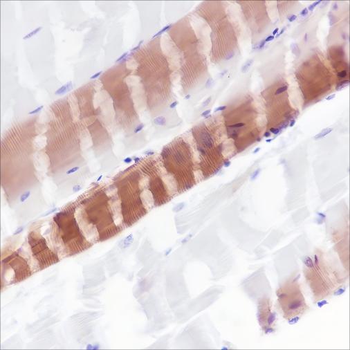 Recombinant Myosin Light Chain 3 Monoclonal Antibody - small - 6