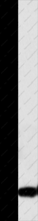 Claudin 1 Polyclonal Antibody - 1