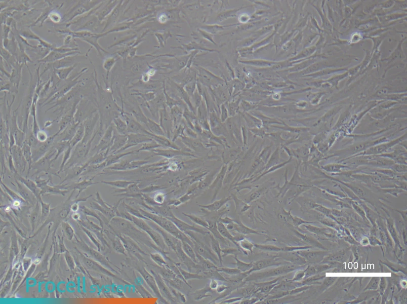 Human Gingival Fibroblast Complete Medium - 1