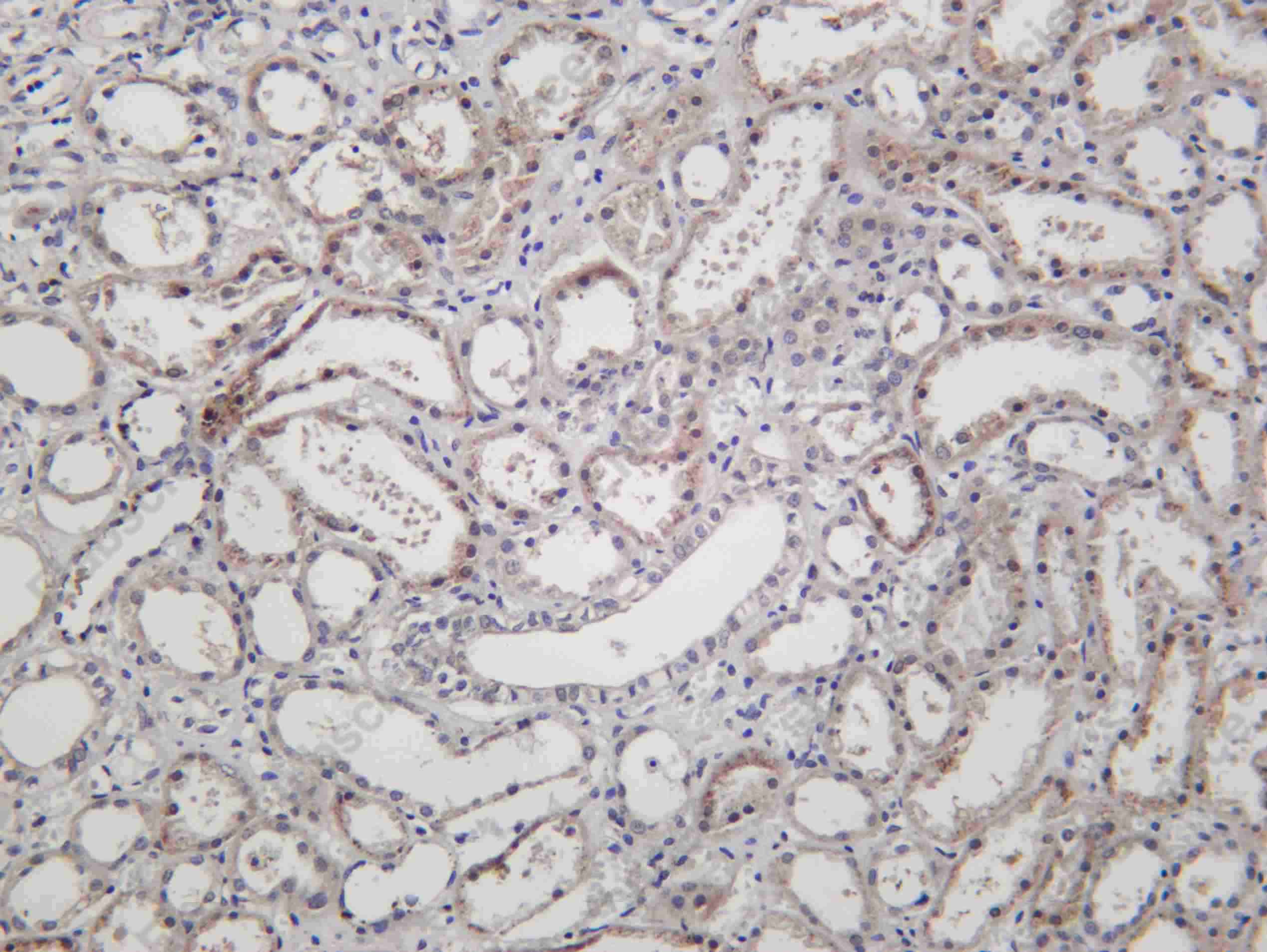 Recombinant p38 MAPK (Phospho Thr180/Tyr182) Monoclonal Antibody - 1