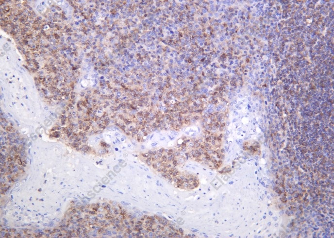 Recombinant AIM2 Monoclonal Antibody - 1