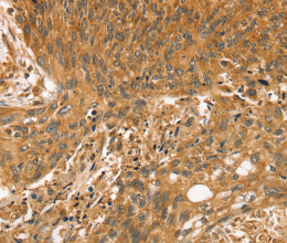 STX10 Polyclonal Antibody - 2