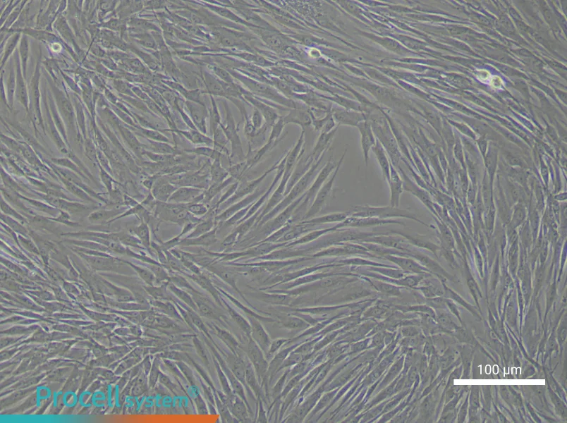 Human Endometrial Stromal Cell Complete MediumHuman Endometrial Stromal Cell Complete Medium - 3