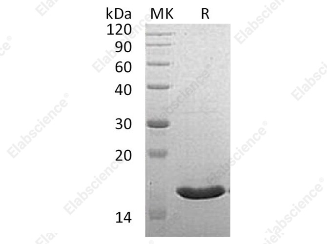 Recombinant Human VAPB Protein (His Tag) - 1