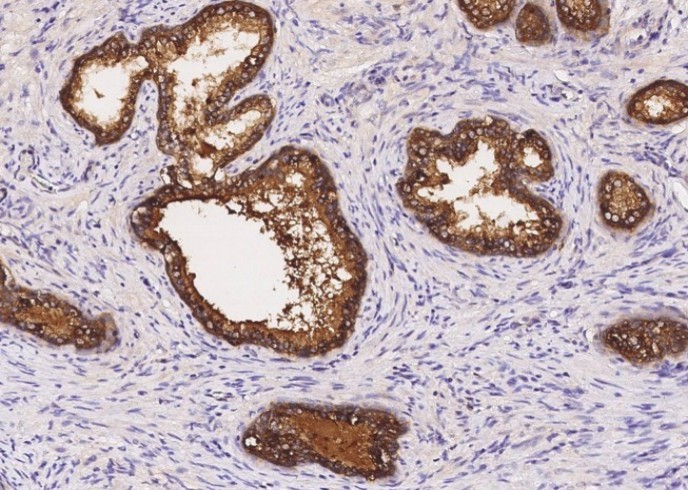 SIAE/sialate O-acetylesterase Monoclonal Antibody - small - 1