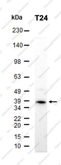 Recombinant IGFBP6 Monoclonal Antibody - 2