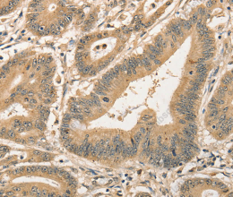 CDCA8 Polyclonal Antibody - 2