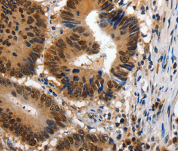 14-3-3 epsilon Polyclonal Antibody - 2
