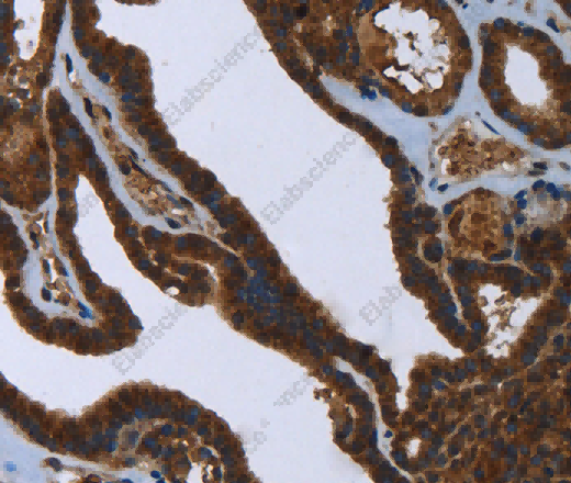 FASTKD2 Polyclonal Antibody - 2