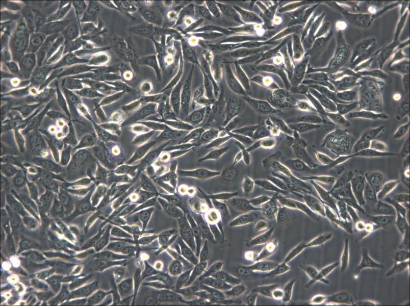 NUGC-3 Cell Complete Medium - 4