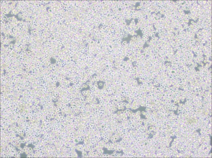 RPMI 8226 Cell Complete Medium - 3