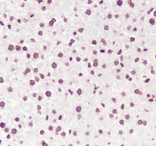 Recombinant SP1 Monoclonal Antibody - small - 6