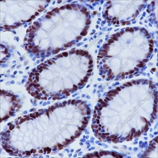 Recombinant MSH6 Monoclonal Antibody - 3