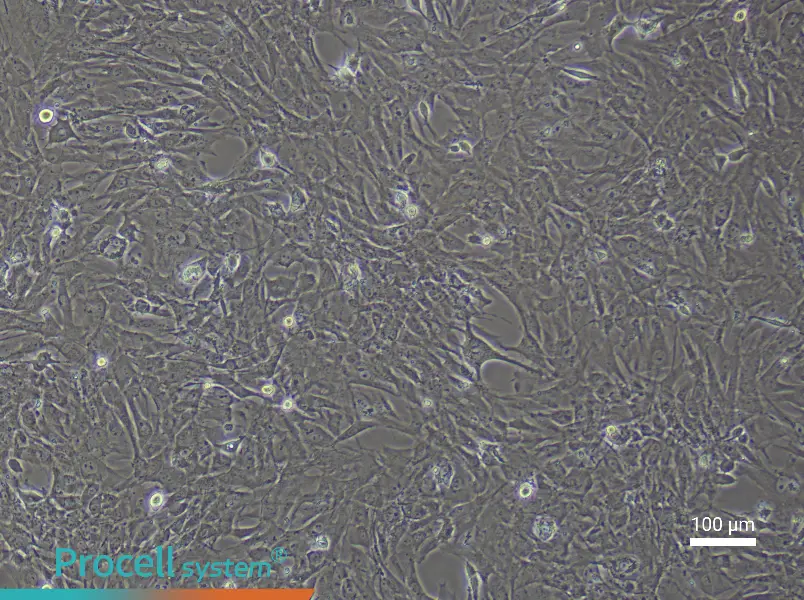Rat Skeletal Muscle Fibroblast Complete Medium - 2