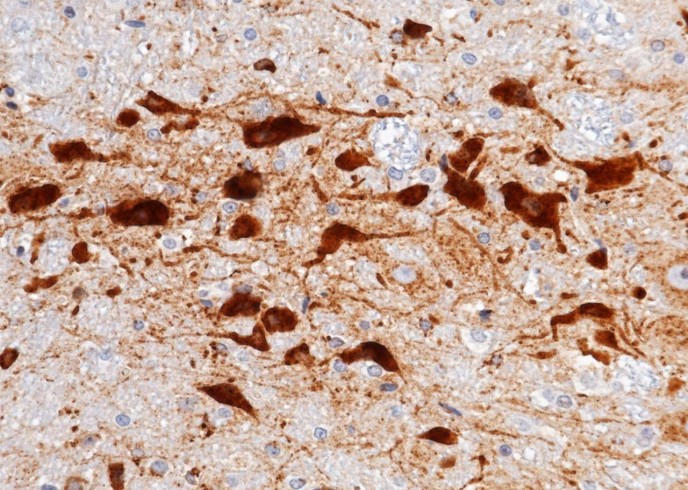 Recombinant Cystatin C/CST3 Monoclonal Antibody - small - 2