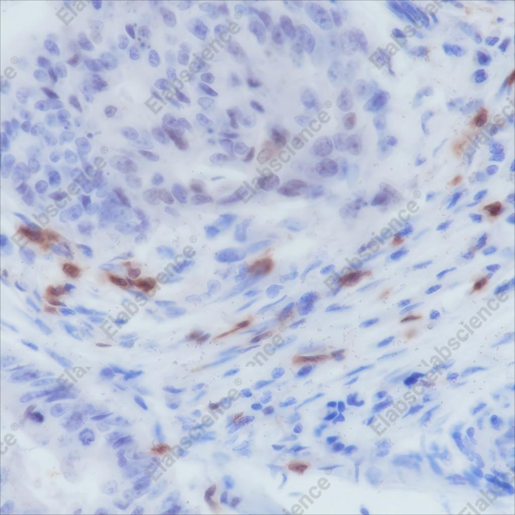 Recombinant CD103 Monoclonal Antibody - 1