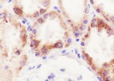 Recombinant GSTK1 Monoclonal Antibody-searchlist-2