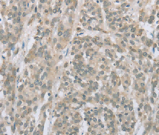 EDA2R Polyclonal Antibody - 2