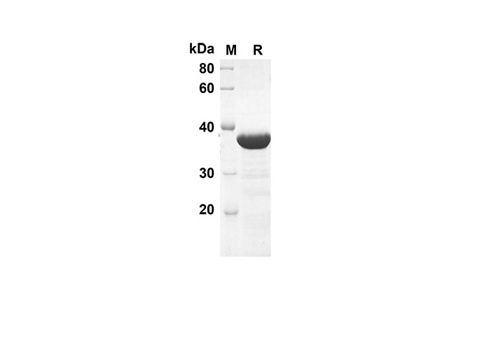 Recombinant Rat IL-1b Protein(Trx Tag)-产品推荐-1