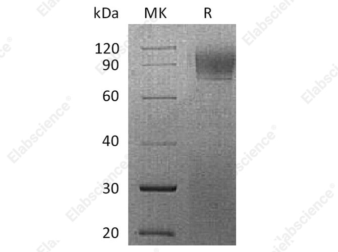 Recombinant Rhesus macaque IFNAR1 Protein (His Tag) - 1