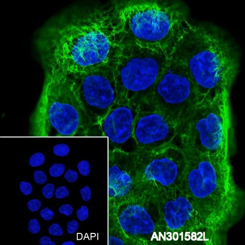 Recombinant Keratin 6 Monoclonal Antibody - small - 6