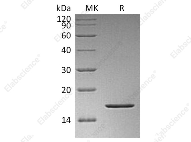 Recombinant Human FGF-2/FGF basic/FGFb Protein - 1