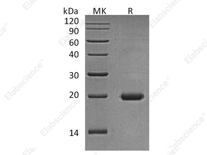 Recombinant Human Interleukin-17D/IL-17D Protein - 1
