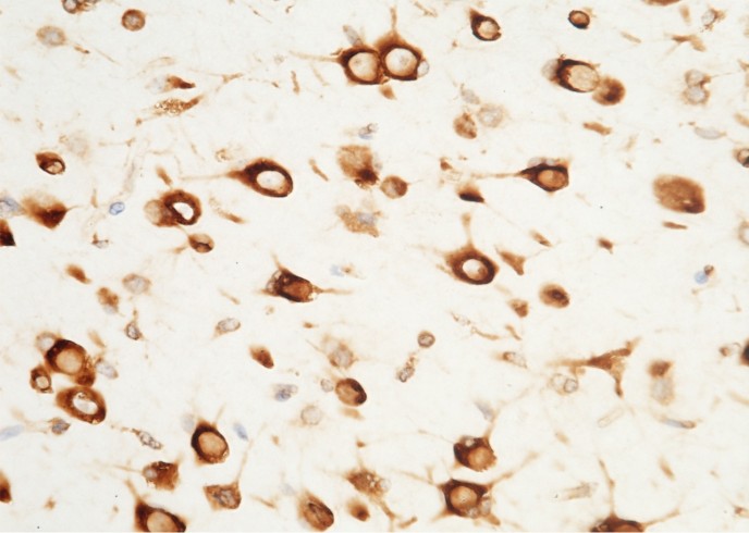 Recombinant SerpinF2 Monoclonal Antibody-searchlist-1