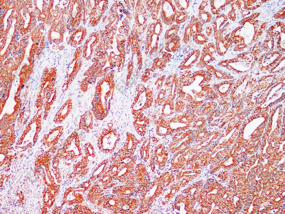 Recombinant IL-1RA/IL1RN Monoclonal Antibody - 1