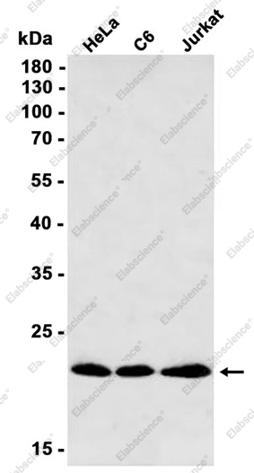 Recombinant Presenilin 1 Monoclonal Antibody - 1