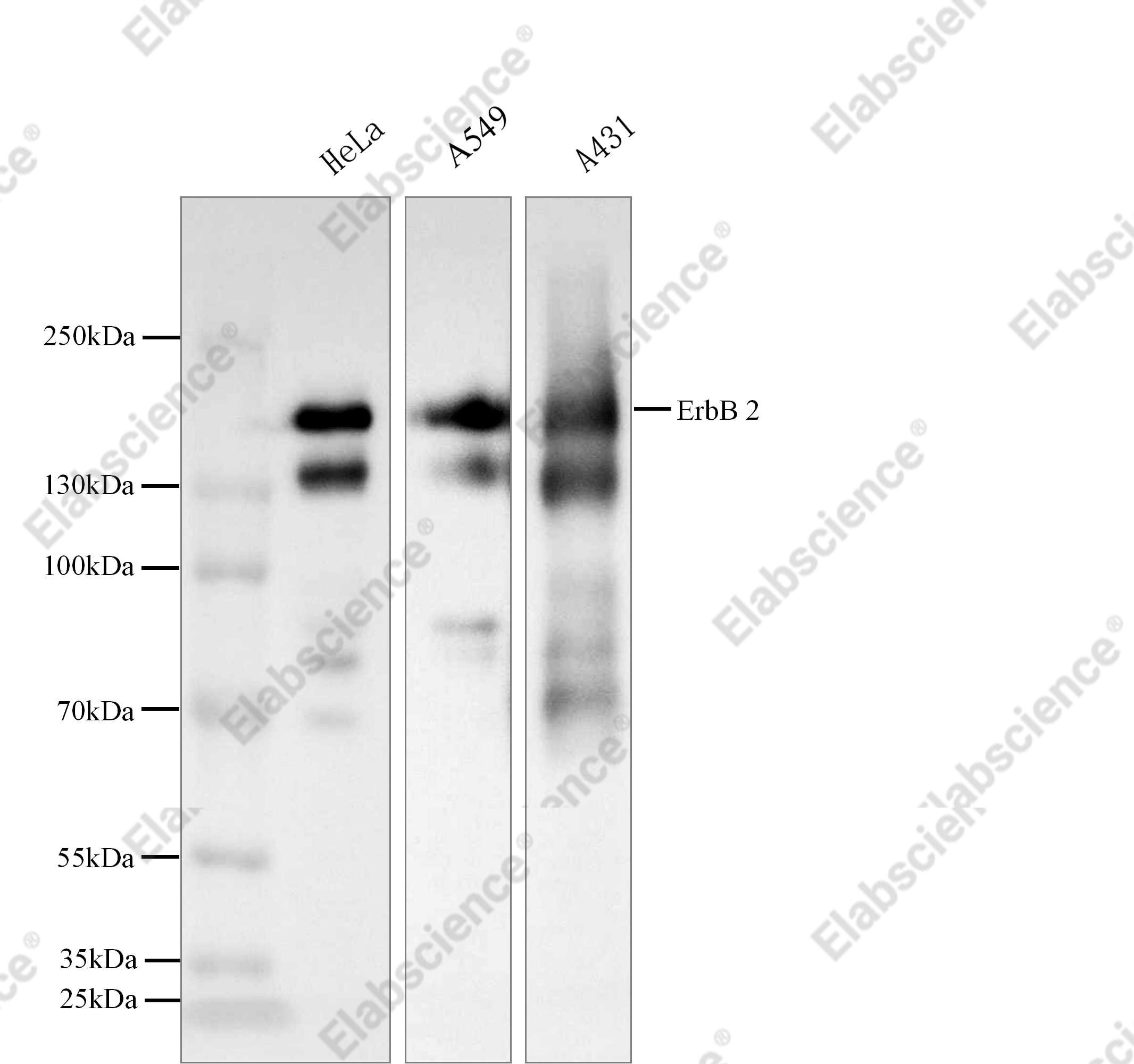 Recombinant HER2/ErbB2/CD340 Monoclonal Antibody - 2