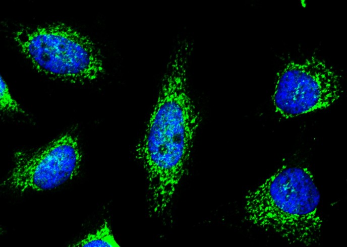 Recombinant Peroxiredoxin 5/PRDX5 Monoclonal Antibody - small - 3