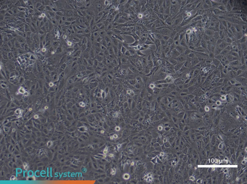 Human Type II Alveolar Epithelial (Primary cell immortalization) Cell Complete Medium - 8