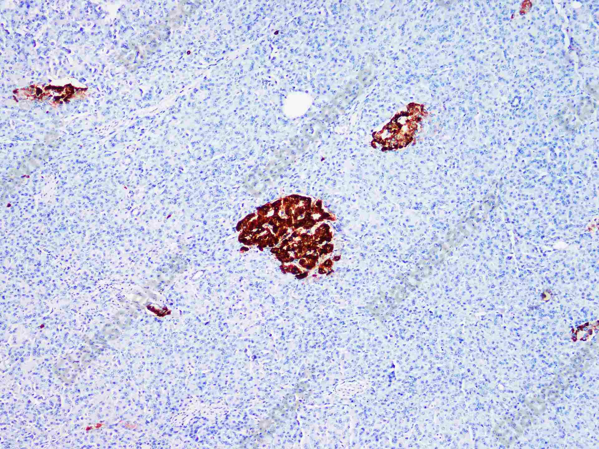 Recombinant Chromogranin A/CHGA/CGA Monoclonal Antibody - 1