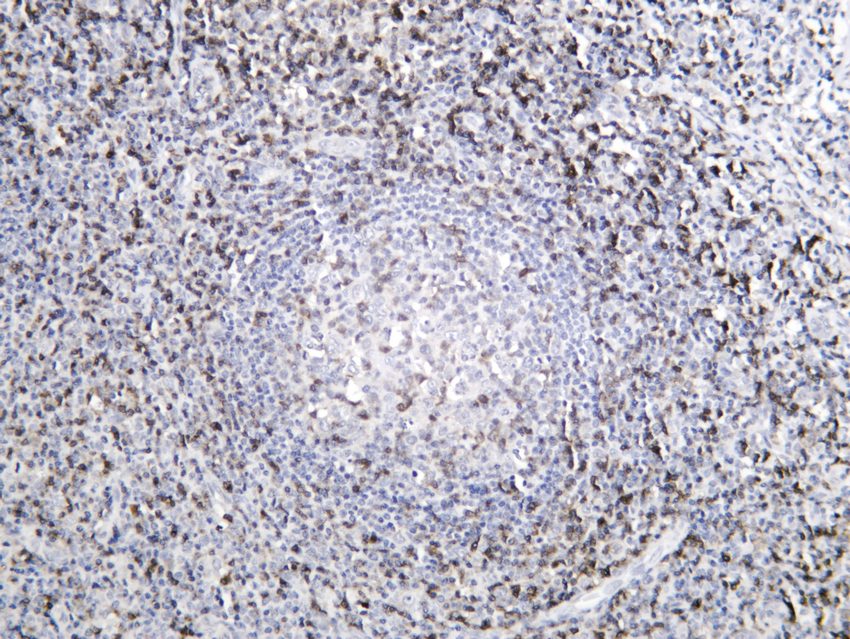 Recombinant CD5/Cluster of Differentiation 5 Monoclonal Antibody - 2