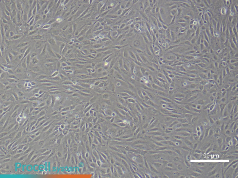 Human Endometrial Epithelial Cell Complete Medium - 1