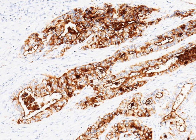 Recombinant Phospho-EGF Receptor (Tyr845) Monoclonal Antibody-searchlist-1