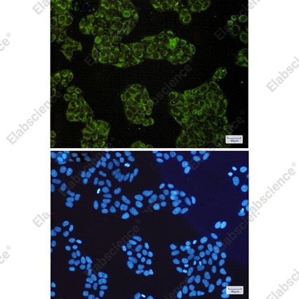 Recombinant SMAC/Diablo Monoclonal Antibody - 4